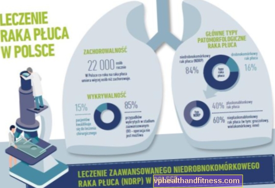 El tiempo es esencial en el cáncer de pulmón