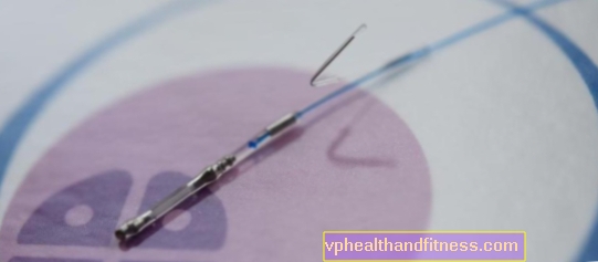 AneVivo - een nieuwe methode voor de behandeling van onvruchtbaarheid. Is het een alternatief voor IVF?