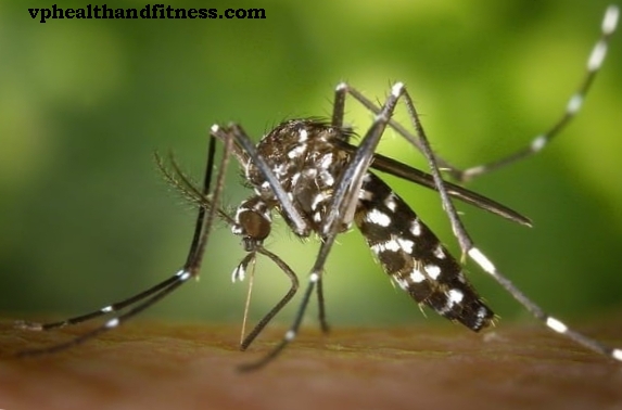 Вірус Chikungunya може викликати енцефаліт