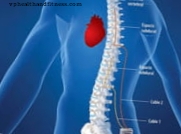 Ārstējiet sirds mazspēju ar mugurkaula stimulatoru