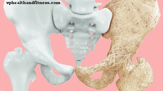 Kinesisk vismann mot osteoporose