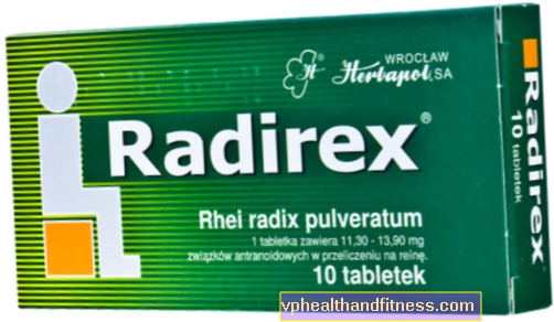 Radirex