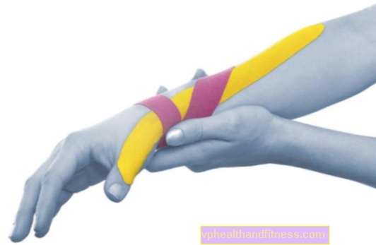 Kinesiotaping (grabación dinámica): ¿cómo funciona?