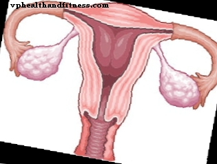 Fibroma: Lieky, embolizácia, ultrazvuk a chirurgický zákrok