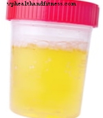 Urine avec mousse - Causes