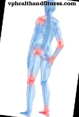 Vertebroplastika: technika nuo skausmo