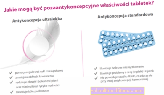 Як вибрати протизаплідні таблетки, тобто спеціальну контрацепцію