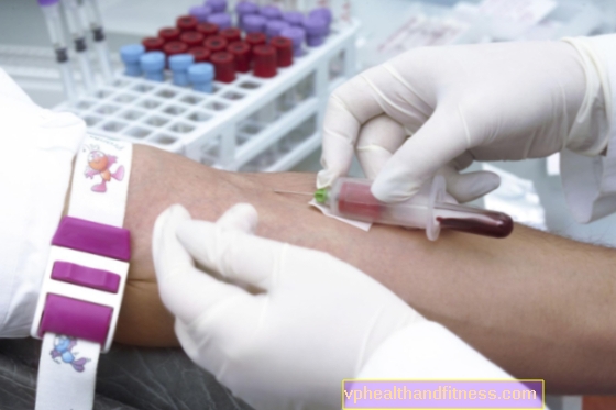 Análisis de sangre: morfología, bioquímica, frotis