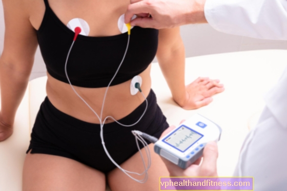 Holter: ¿cómo se realiza la prueba Holter?