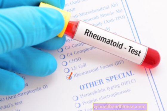 FR o factor reumatoide: definición, detección e importancia en patología