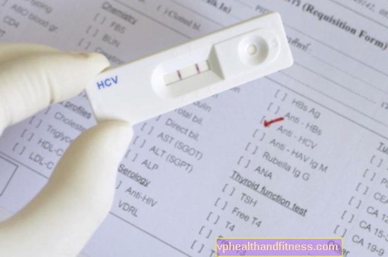 Prueba de VHC: ¿por qué debería hacerlo?