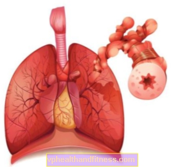 Prueba de capacidad pulmonar