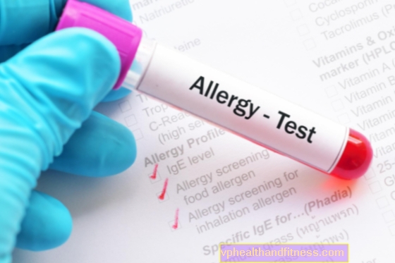 RAST-test (radioallergia eraldamise test): millal seda teha? Kuidas läheb?