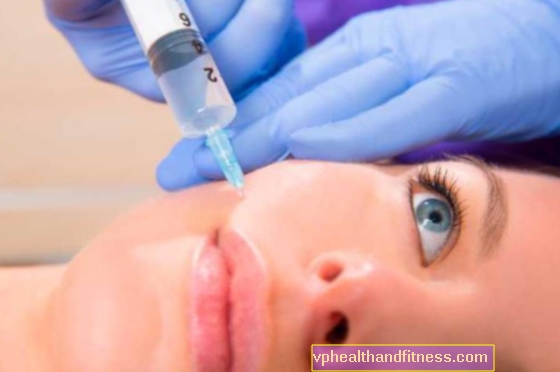 Lifting facial de vampiro, es decir, terapia con plasma rico en plaquetas. ¿Qué es la eliminación de arrugas con sangre?