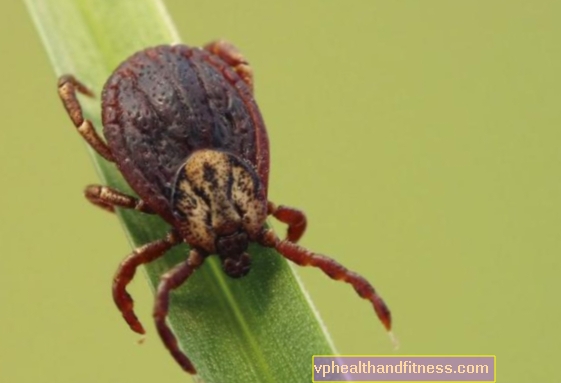 Maladie de Lyme - causes, symptômes et traitement de la maladie de Lyme