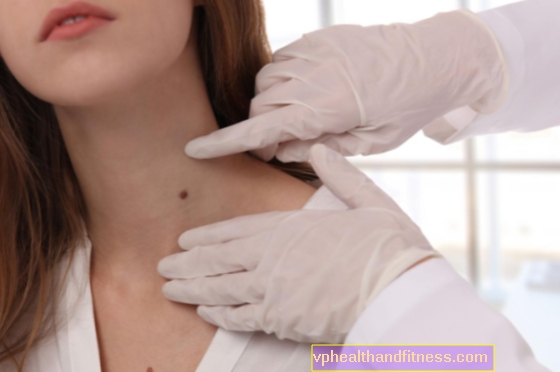 Pelle secca con acne: come lavare il fondotinta? 