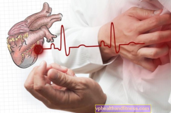 Enfermedad coronaria (cardiopatía isquémica): diagnóstico y tratamiento. ¿Cómo tratar la enfermedad de las arterias coronarias?