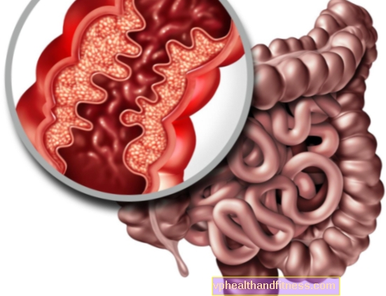 Enfermedades intestinales