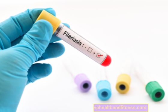 Filariasis : 원인, 유형, 증상, 치료