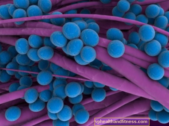 Staphylococcus: gejala khas dan rawatan jangkitan staphylococcal