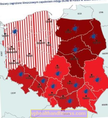 Кліщовий енцефаліт: симптоми та лікування, ускладнення