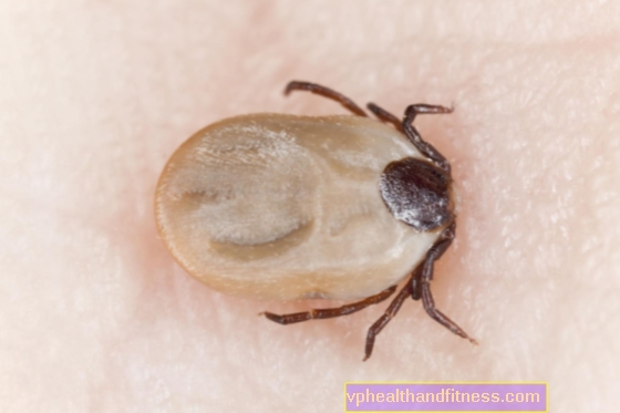 Tratamiento de la enfermedad de Lyme: métodos IDSA e ILADS