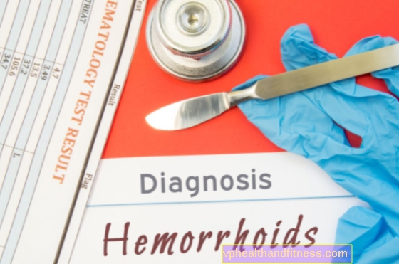 Tratamiento de hemorroides. ¿Cómo tratar eficazmente las hemorroides?