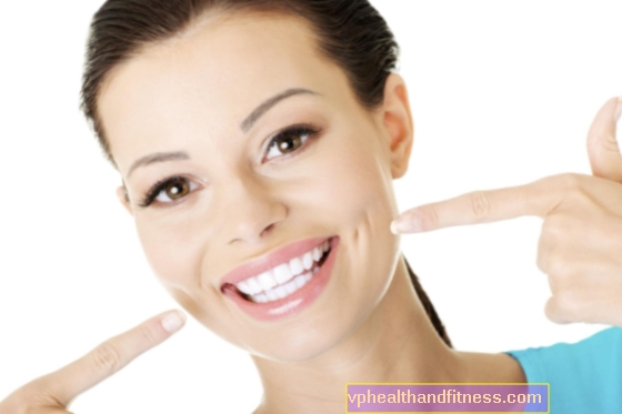 VENEERS - una forma de obtener hermosos DIENTES