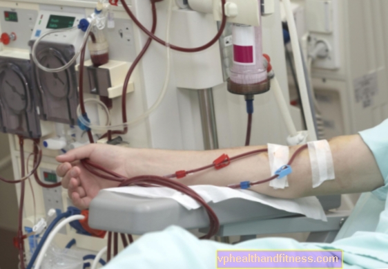 Uremia: causas, síntomas, tratamiento