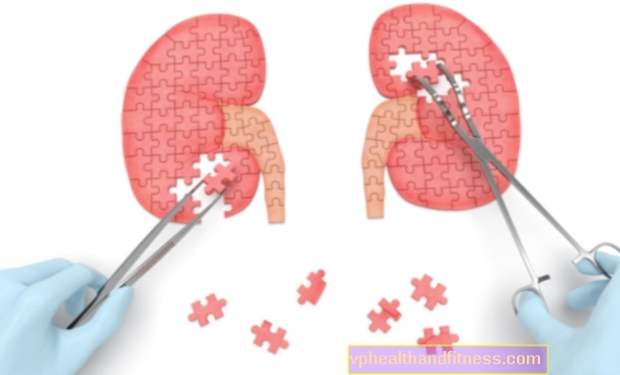 Nefropatía diabética. Tratamiento de la enfermedad renal diabética