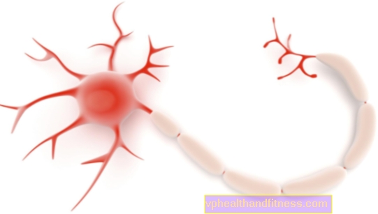 Un neuroma es un tumor del sistema nervioso. Síntomas y tratamiento del neuroma.