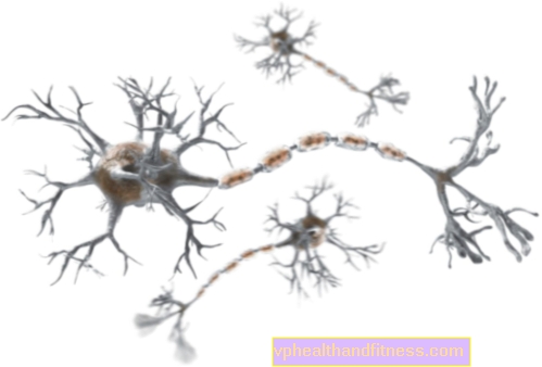 La NEUROPATÍA diabética es una complicación común de la diabetes.