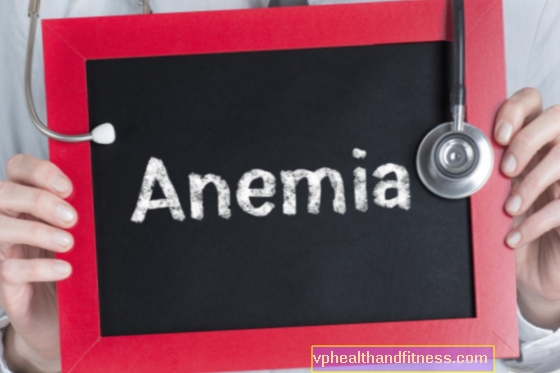 Anemia megaloblastica: cause, sintomi e trattamento