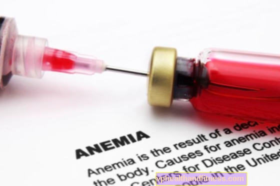 Anemia perniciosa: causas y síntomas. Enfermedad de Addison-Biermer - tratamiento