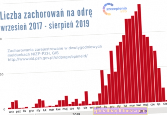 Masalas: cēloņi, simptomi, ārstēšana, komplikācijas, vakcinācija