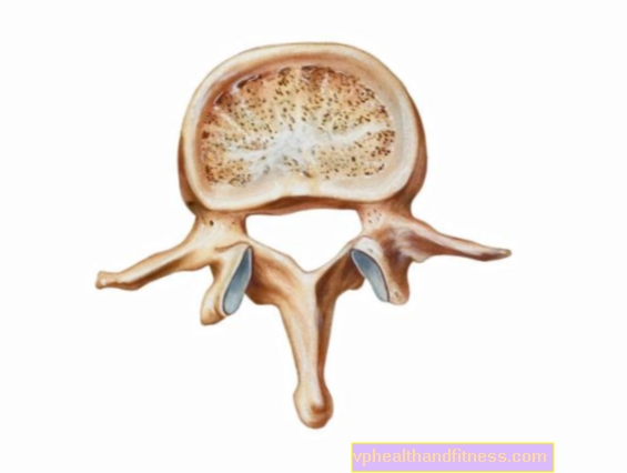 La osteopenia es una enfermedad de los huesos. Causas, síntomas y tratamiento de la osteopenia.