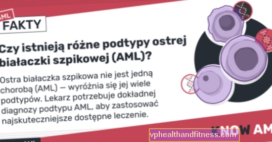 Leucemia mieloide aguda (AML): causas, síntomas y tratamiento