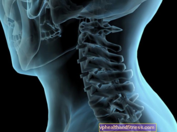 Mielitis transversa aguda: causas, síntomas, tratamiento