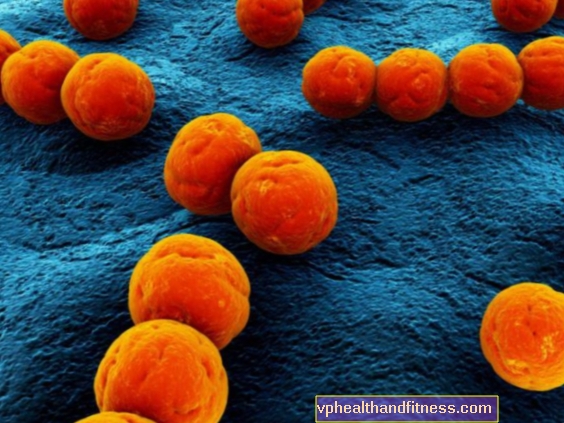 Streptococcus: ¿que es y que enfermedades causa?