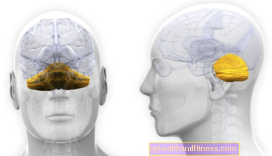 Degeneración paraneoplásica del cerebelo: causas, síntomas y tratamiento.