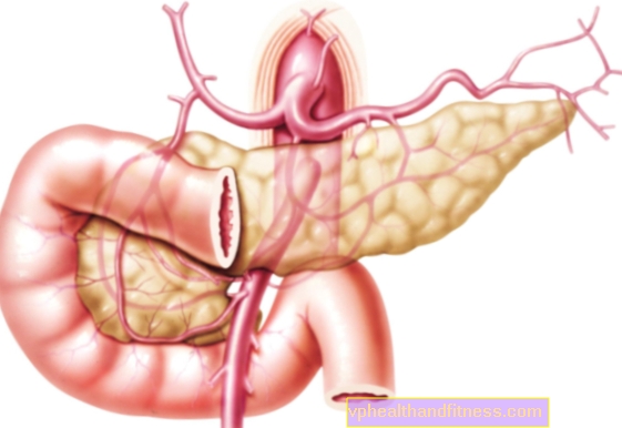 Colangitis esclerosante primaria