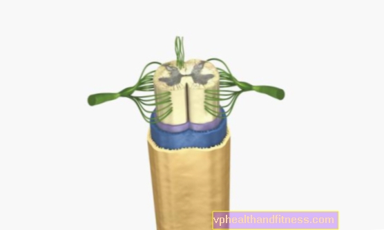 Hernia meníngea: tipos, causas, síntomas, tratamiento.