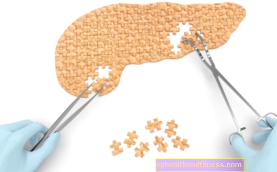 Transplantacija gušterače - indikacije. Što je transplantacija gušterače?
