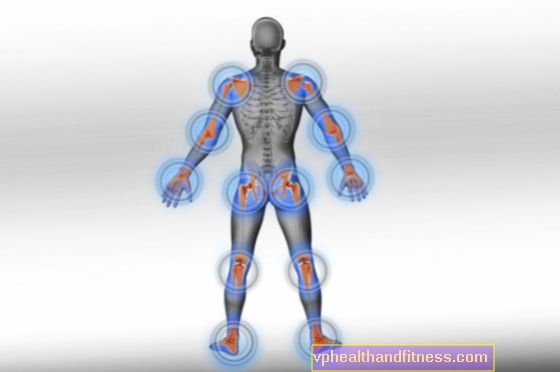 Artritis reactiva: causas, síntomas y tratamiento