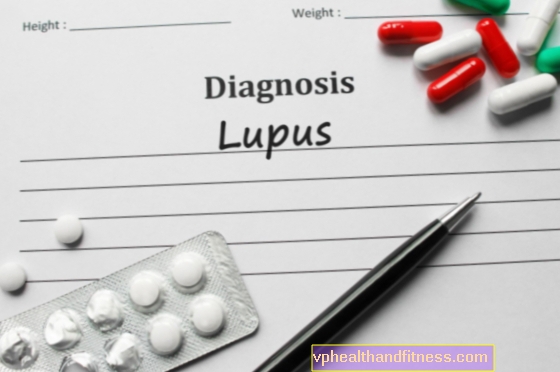 Lupus: causas, síntomas y tratamiento del lupus