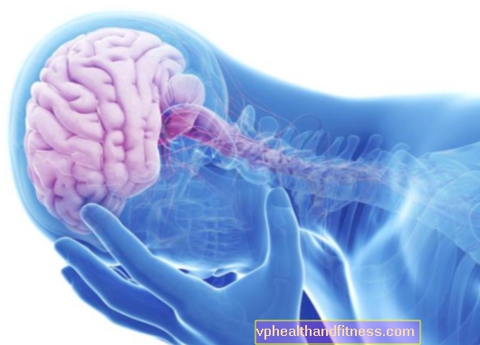 AVC isquêmico (infarto cerebral): sintomas, causas, tratamento, efeitos