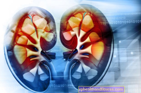 Enfermedad renal poliquística: causas, síntomas, tratamiento.