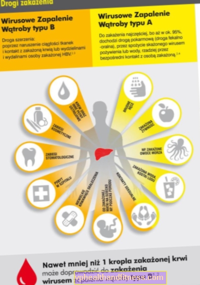 Hepatitis viral (hepatitis)