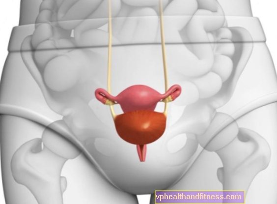 Cistitas - priežastys, simptomai, gydymas