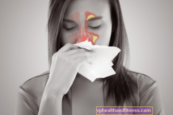 Sinusitis: Perawatan Modern untuk Sinus